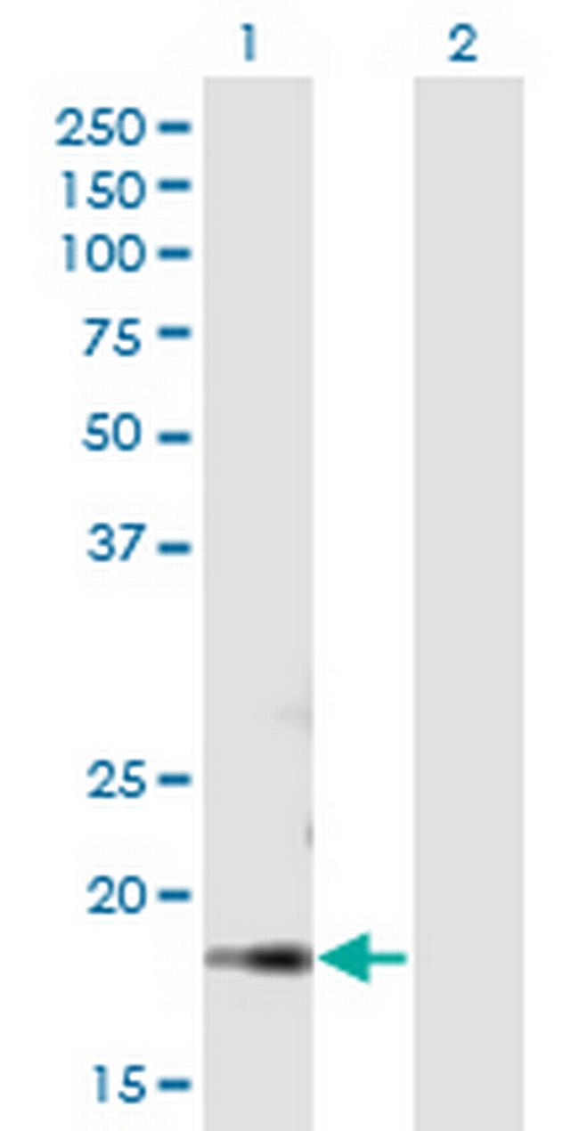 DRF1 Antibody in Western Blot (WB)