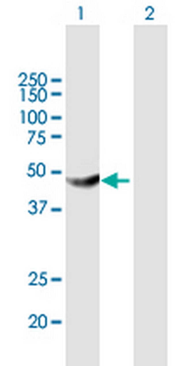 HKDC1 Antibody in Western Blot (WB)