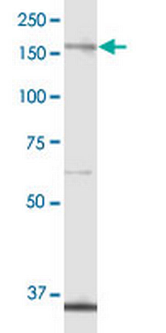 ALPK1 Antibody in Western Blot (WB)