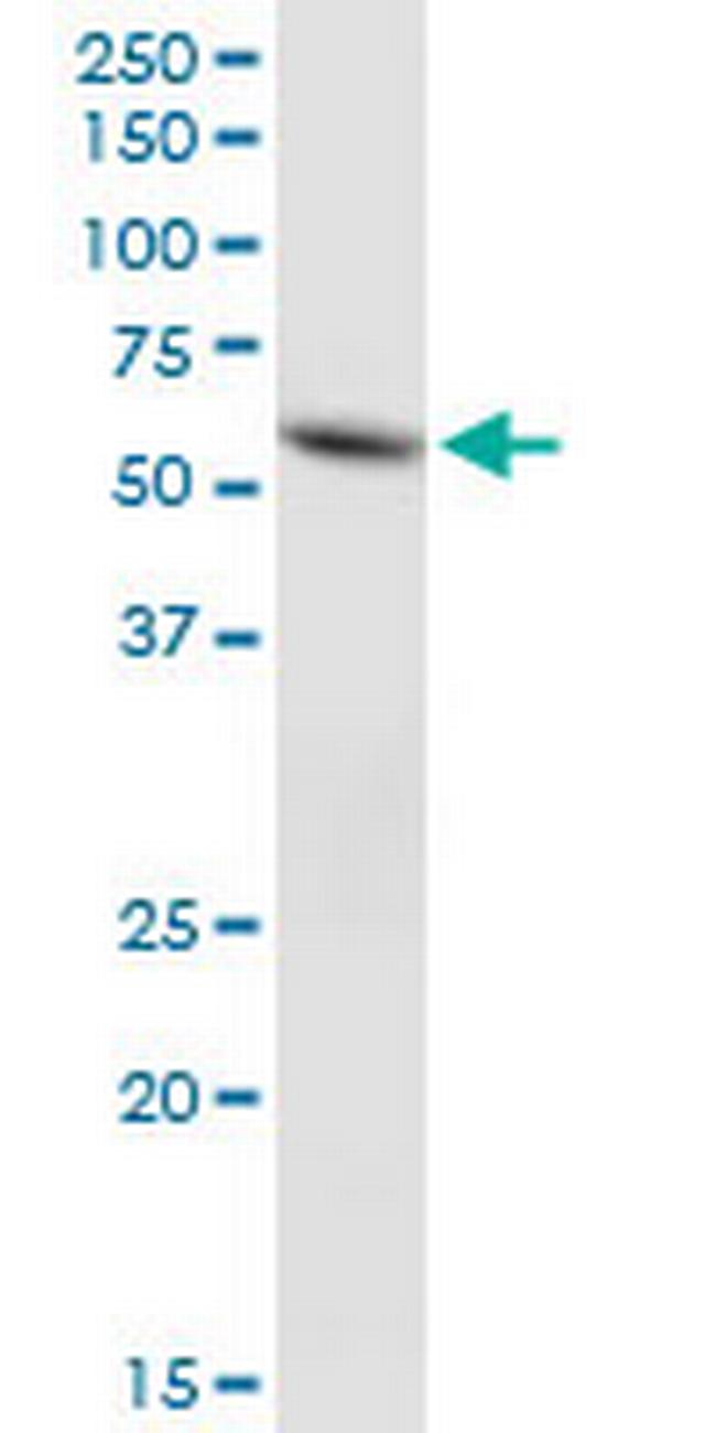 FLJ20920 Antibody in Western Blot (WB)