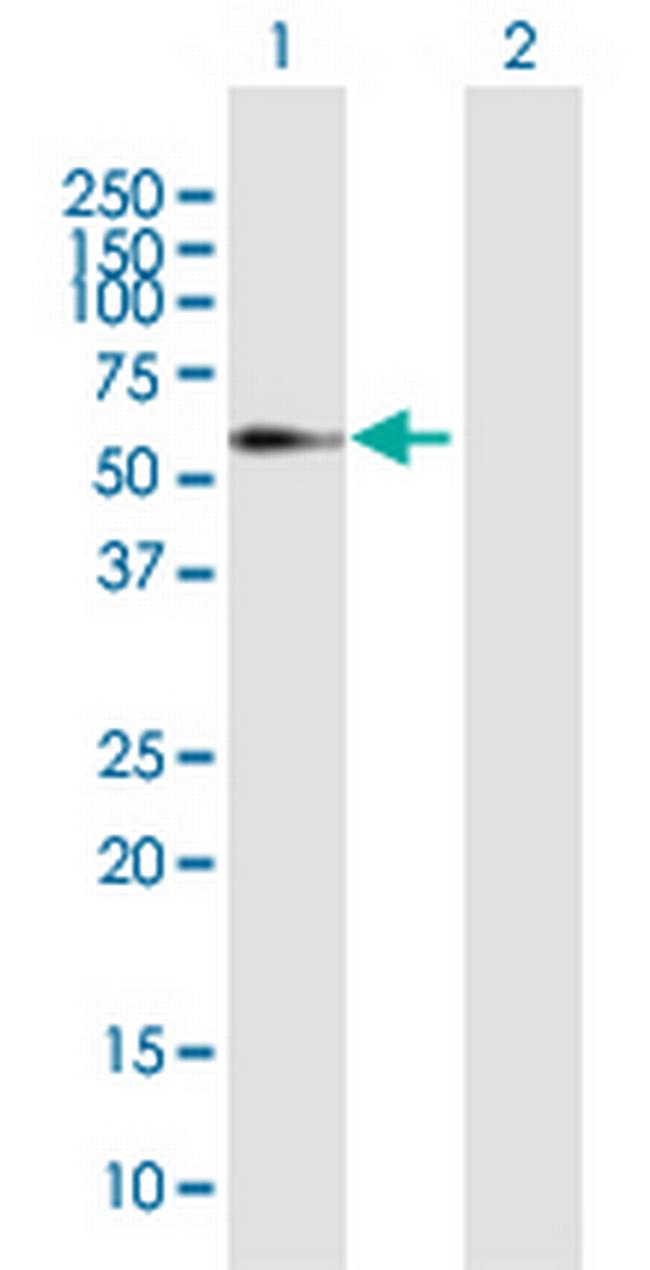 ELL3 Antibody in Western Blot (WB)