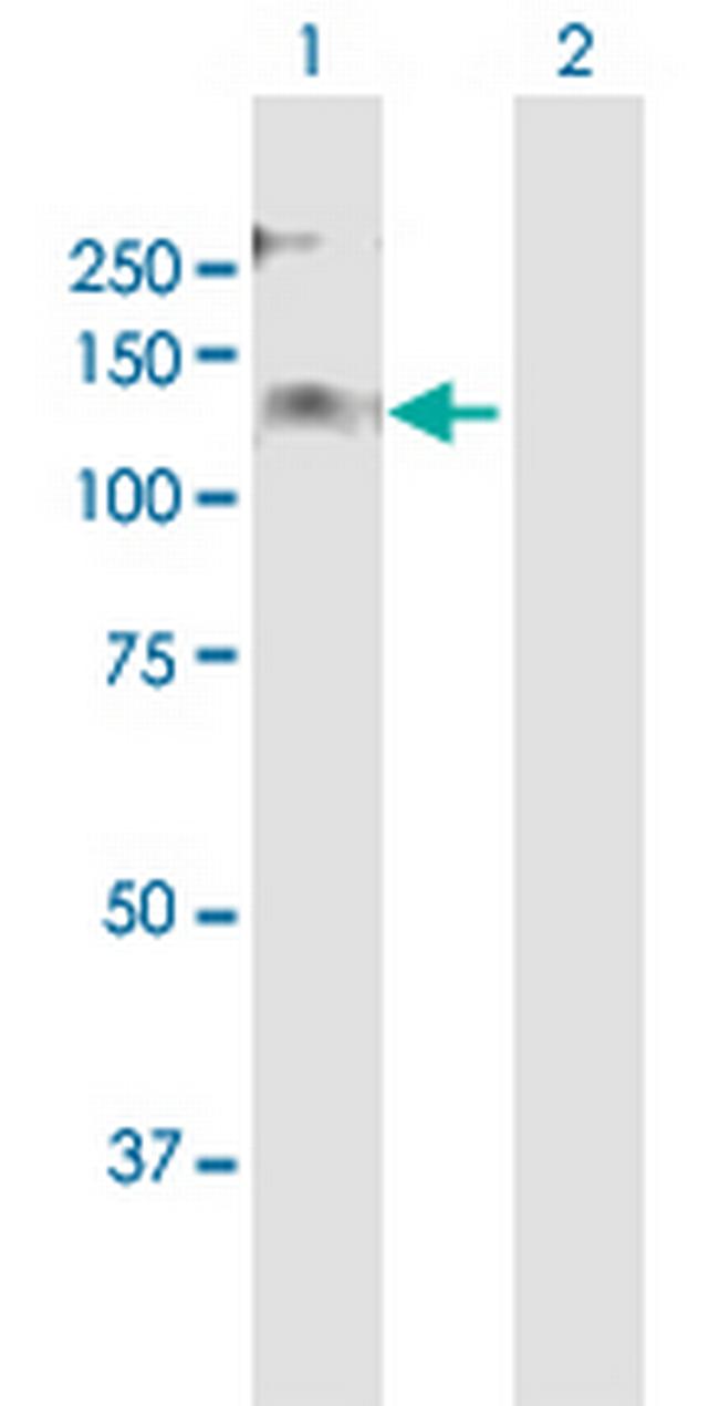 DEPDC2 Antibody in Western Blot (WB)