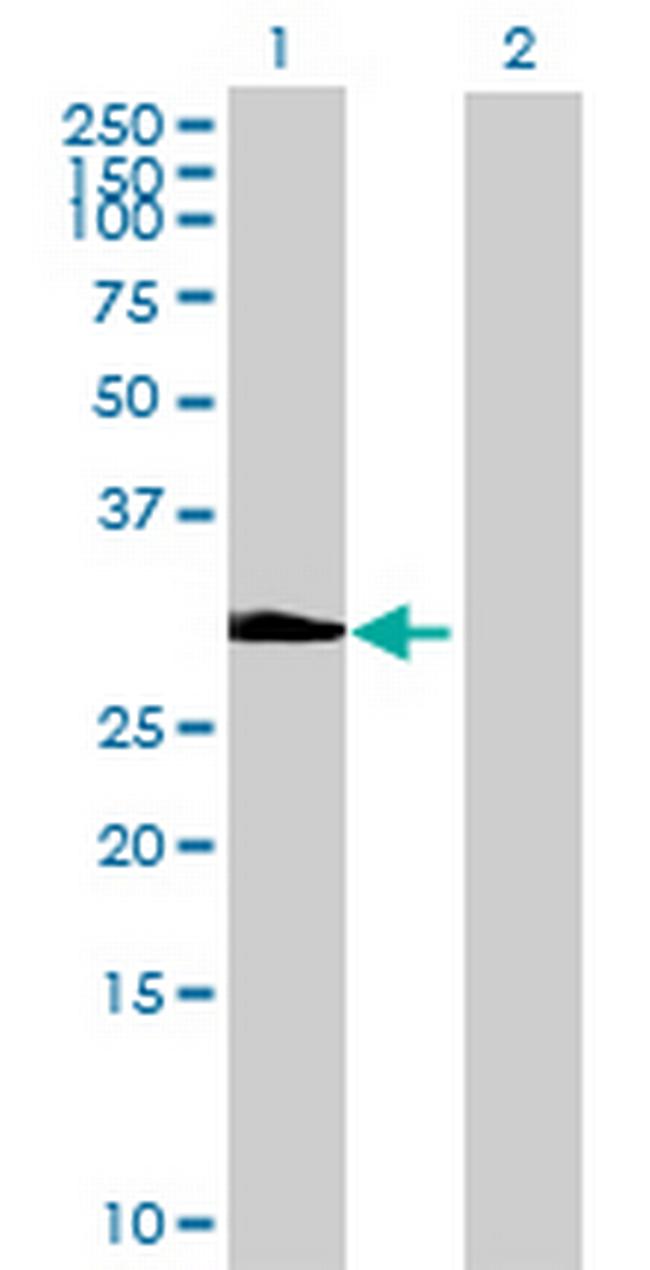 EFHD1 Antibody in Western Blot (WB)