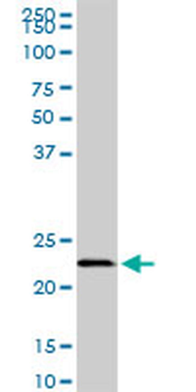 EFHD1 Antibody in Western Blot (WB)