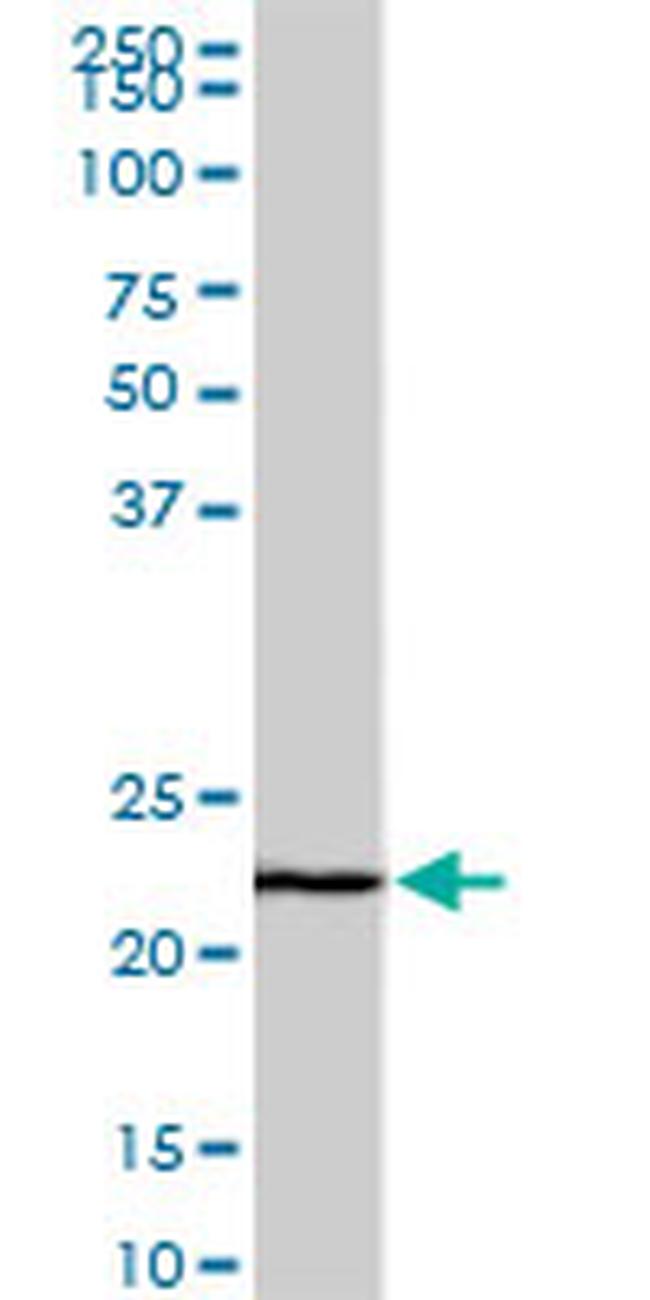 EFHD1 Antibody in Western Blot (WB)