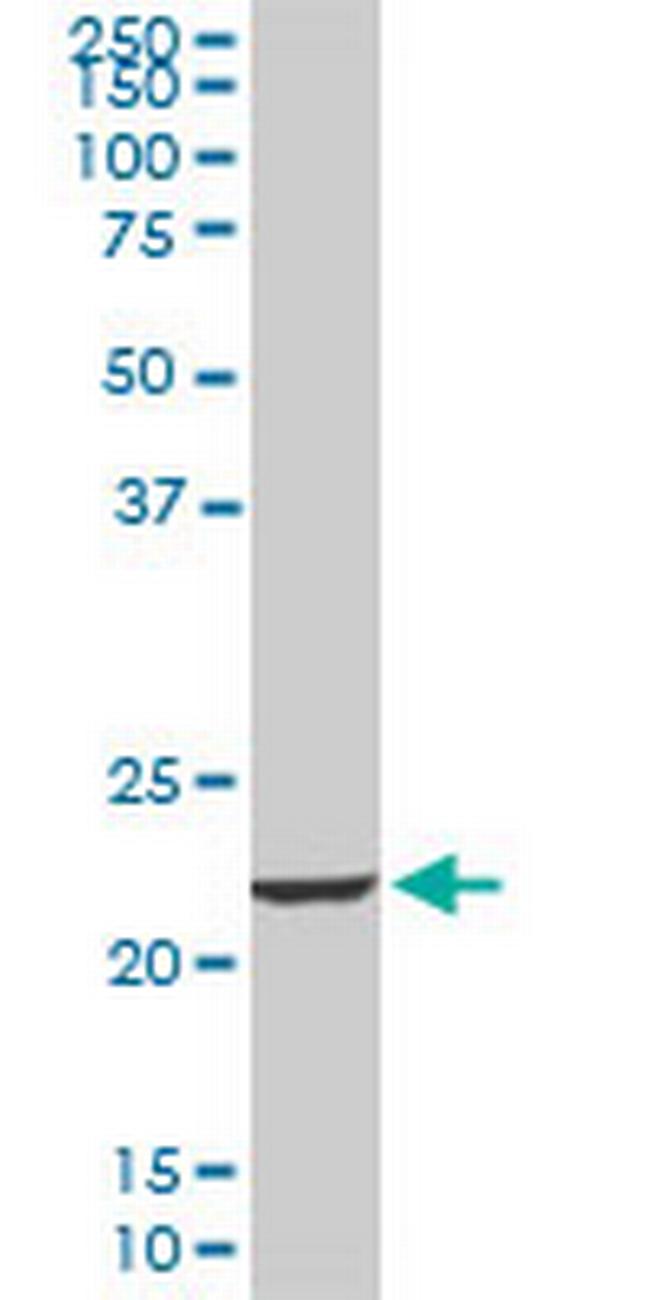 EFHD1 Antibody in Western Blot (WB)