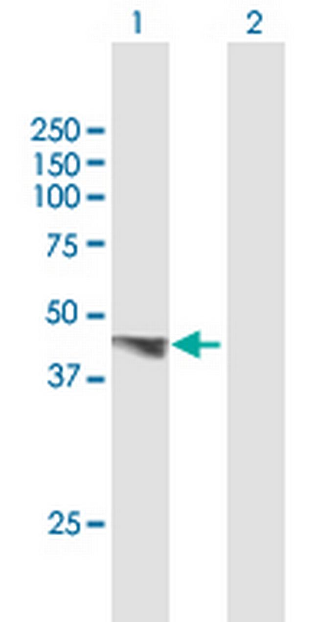 PDGFD Antibody in Western Blot (WB)