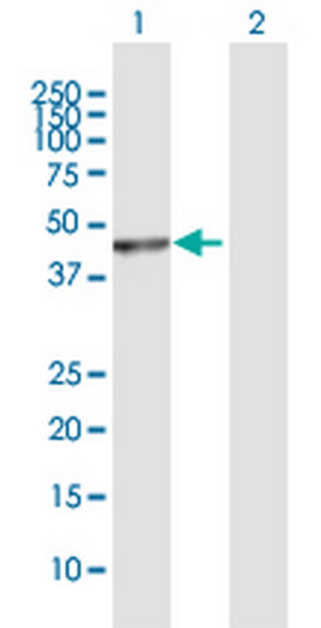 PUS1 Antibody in Western Blot (WB)