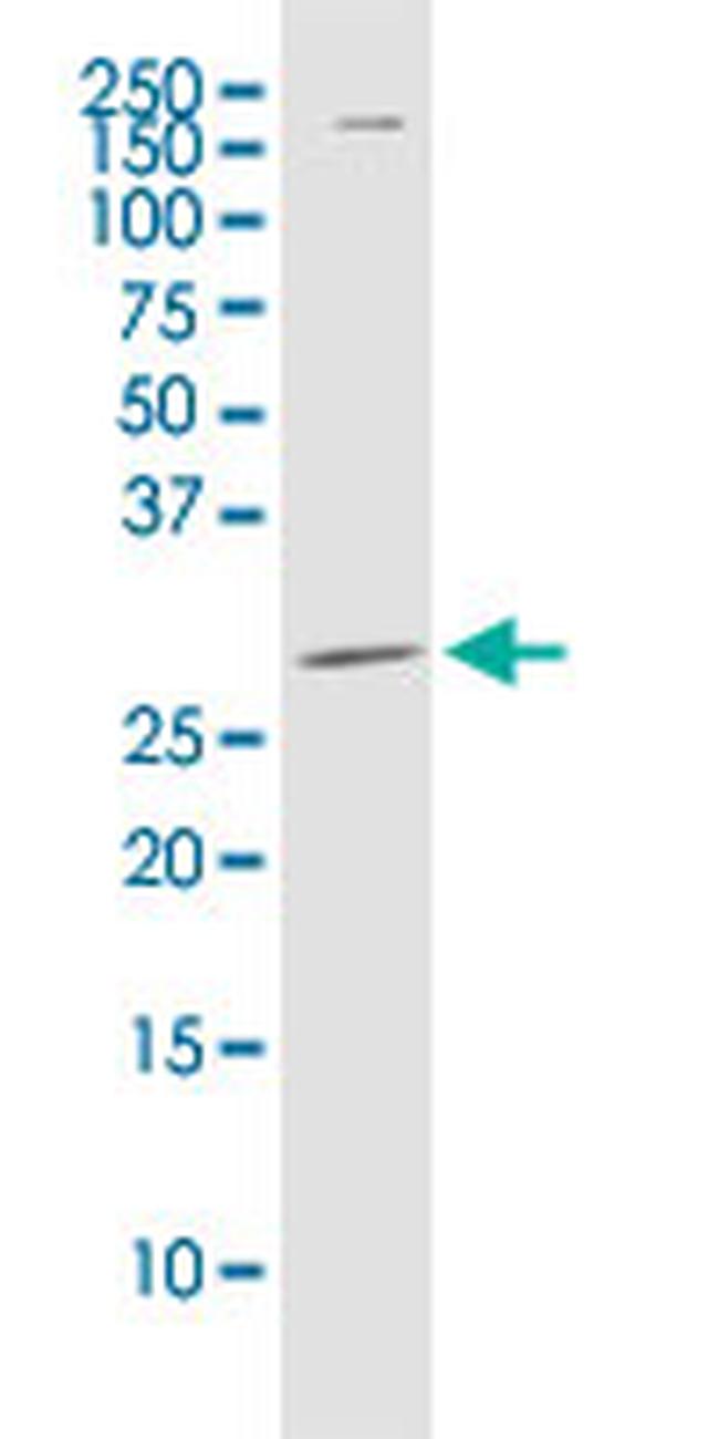 PDCD1LG2 Antibody in Western Blot (WB)