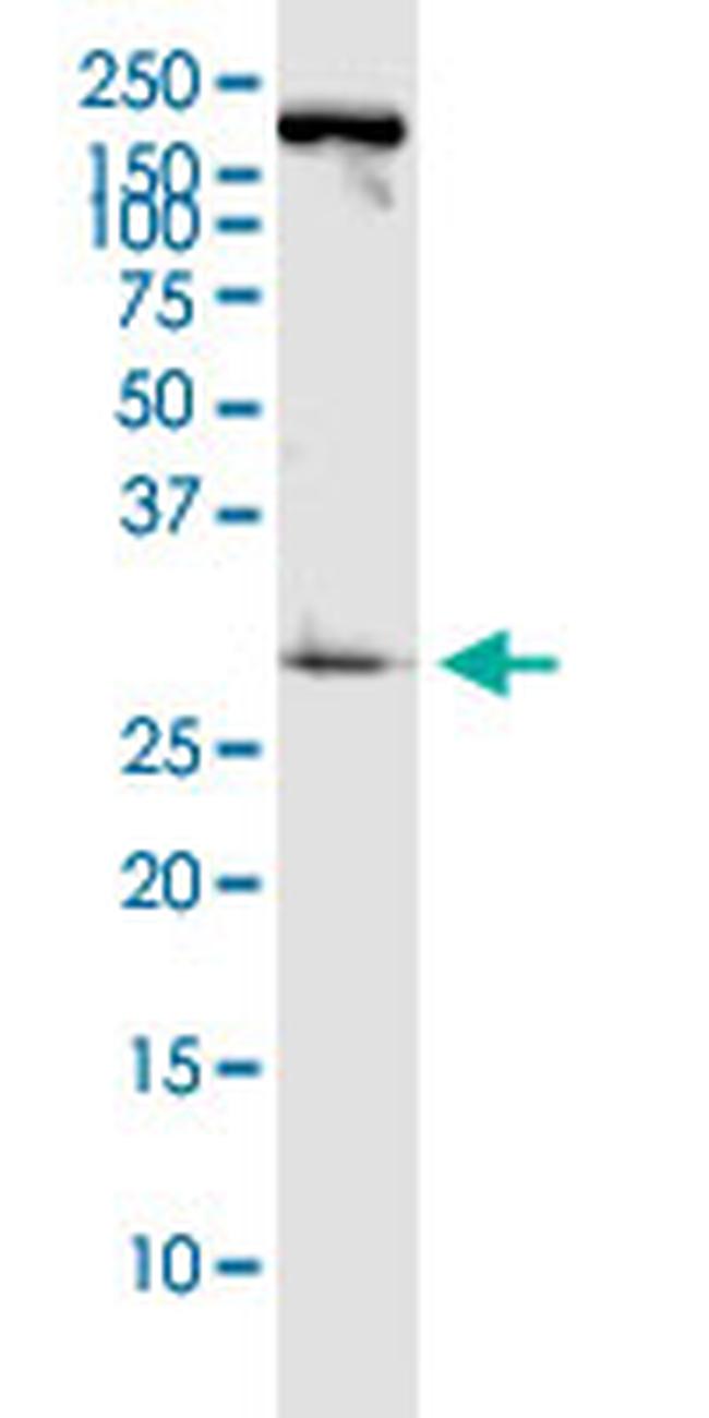 PDCD1LG2 Antibody in Western Blot (WB)