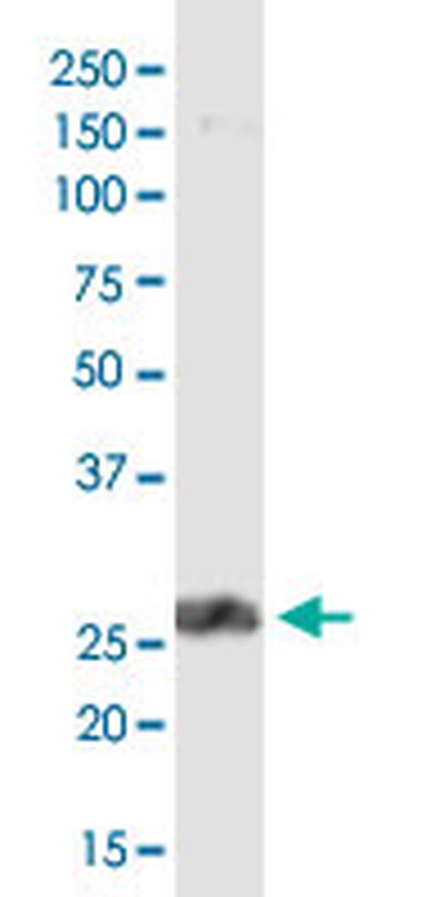 PDCD1LG2 Antibody in Western Blot (WB)