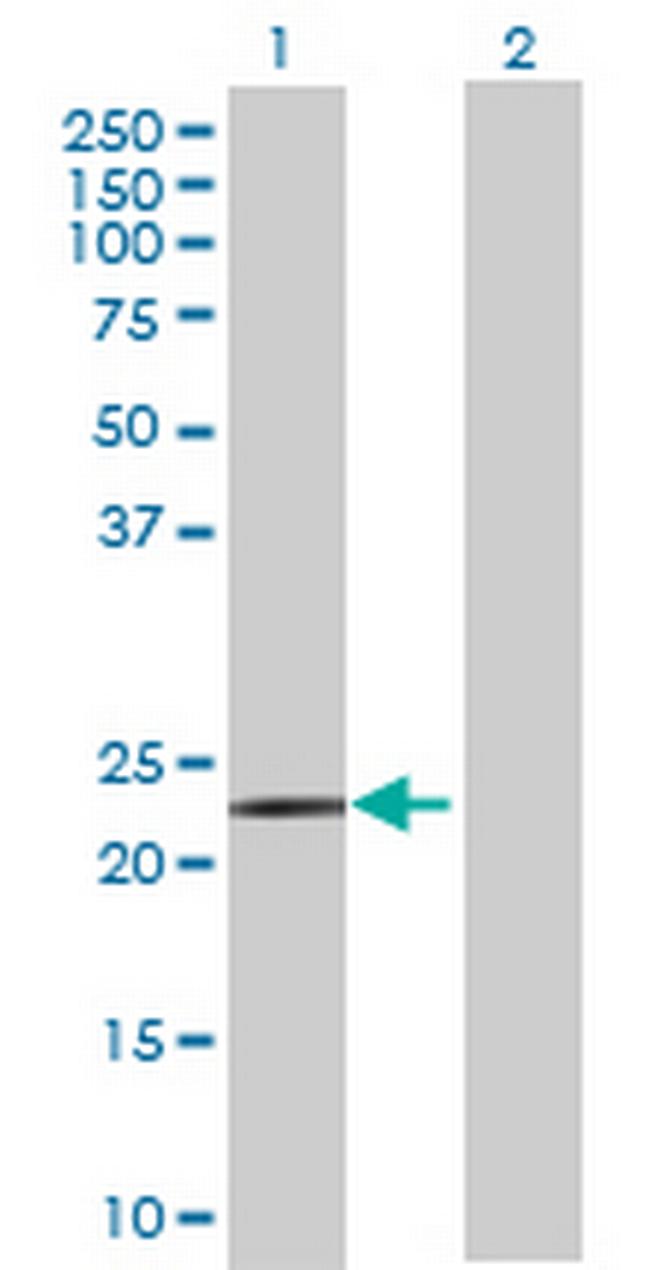 ACAD10 Antibody in Western Blot (WB)