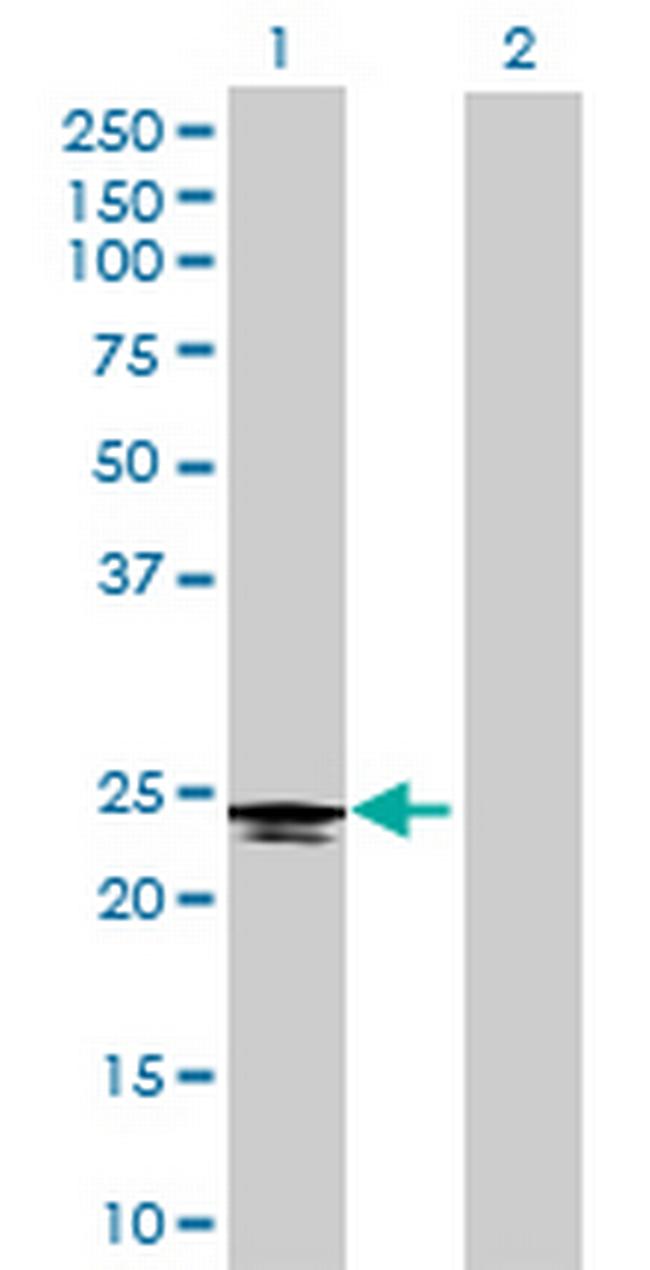 C6orf25 Antibody in Western Blot (WB)