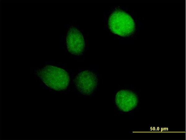 TSEN2 Antibody in Immunocytochemistry (ICC/IF)