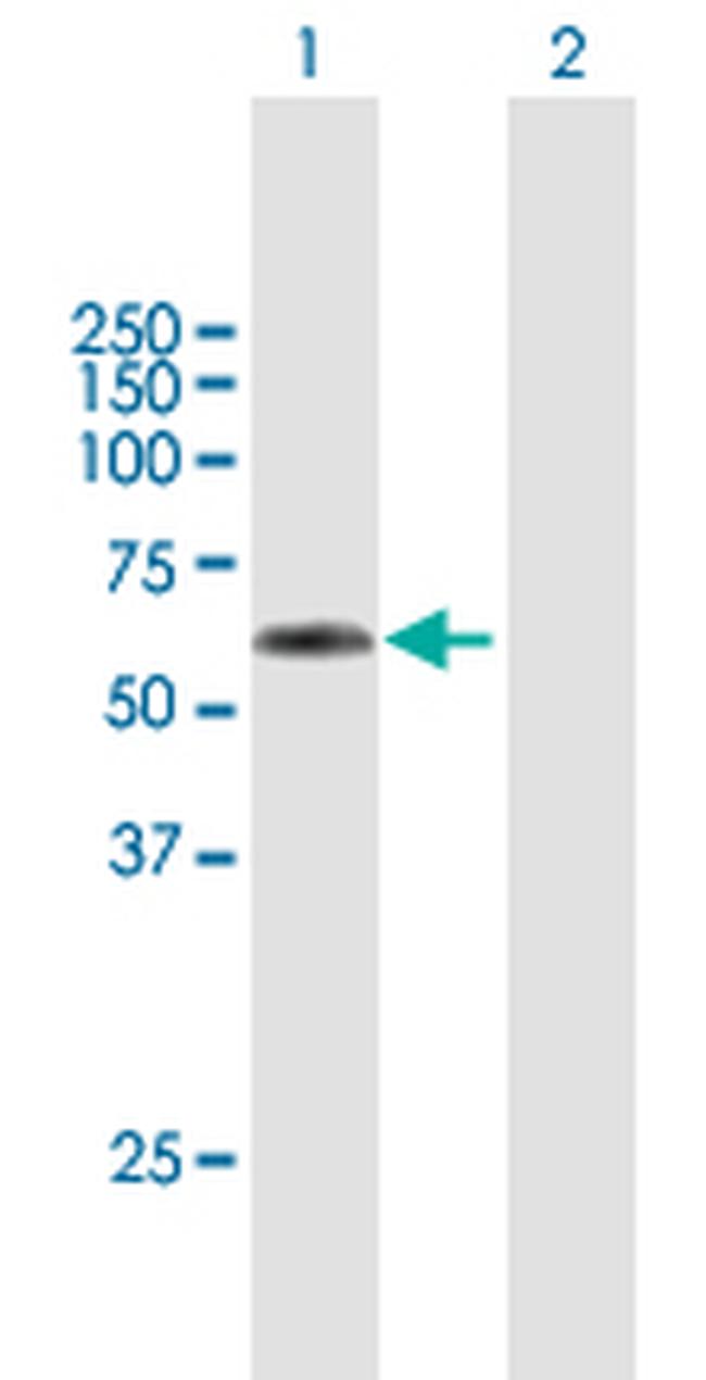 TSEN2 Antibody in Western Blot (WB)