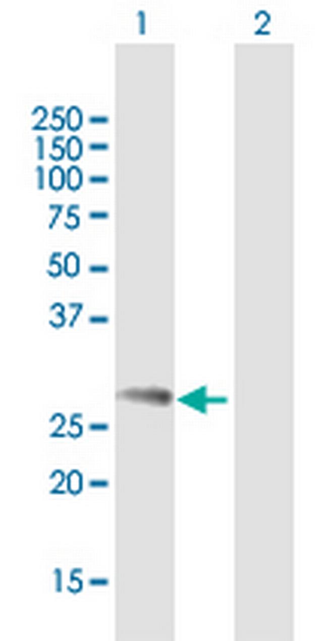 NDFIP1 Antibody in Western Blot (WB)