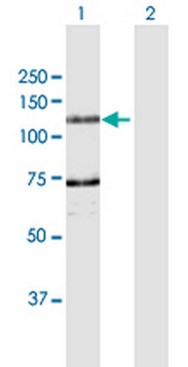 DDHD1 Antibody in Western Blot (WB)