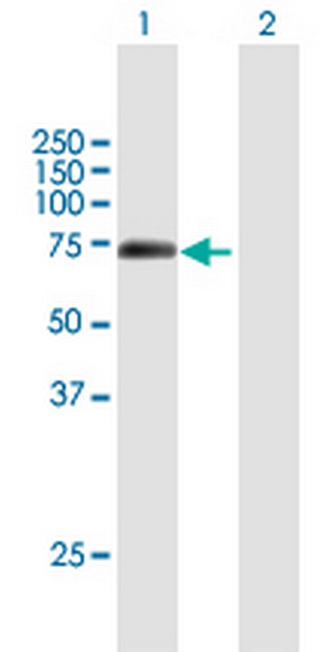 BHLHB9 Antibody in Western Blot (WB)