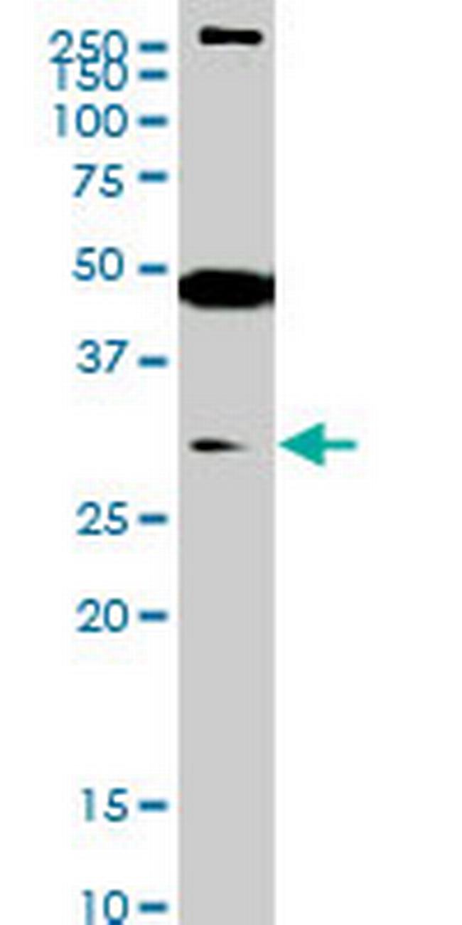 SET7 Antibody in Western Blot (WB)