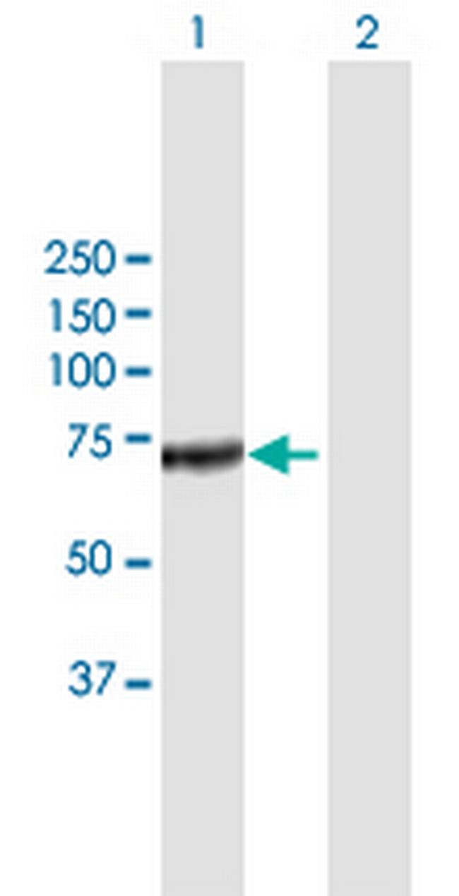 CFHL5 Antibody in Western Blot (WB)