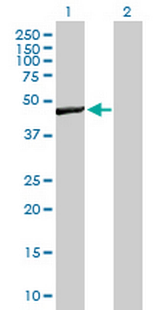 WBSCR16 Antibody in Western Blot (WB)