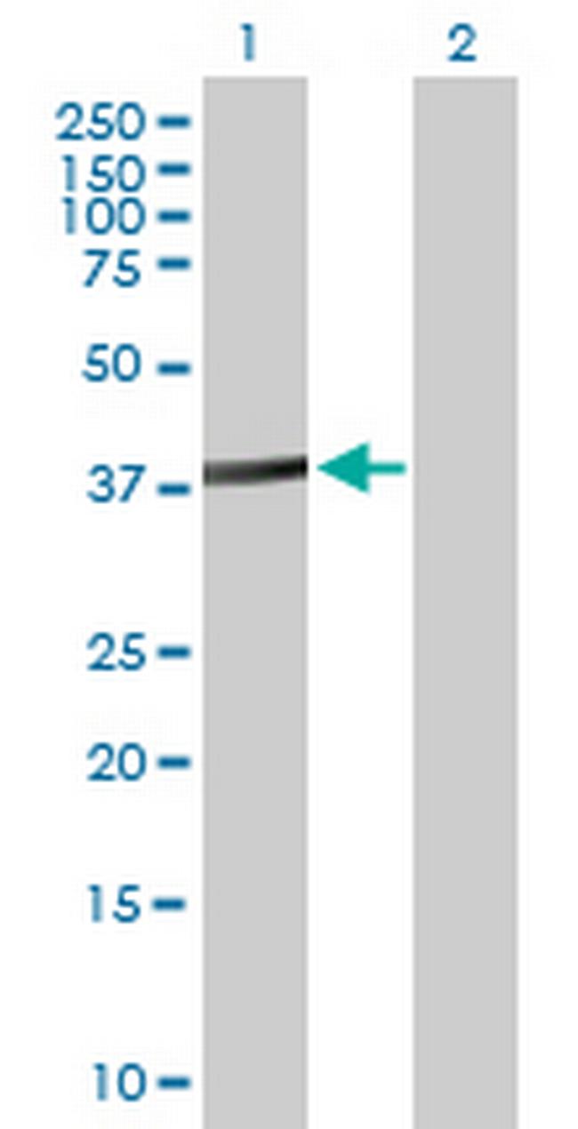 ACTL8 Antibody in Western Blot (WB)