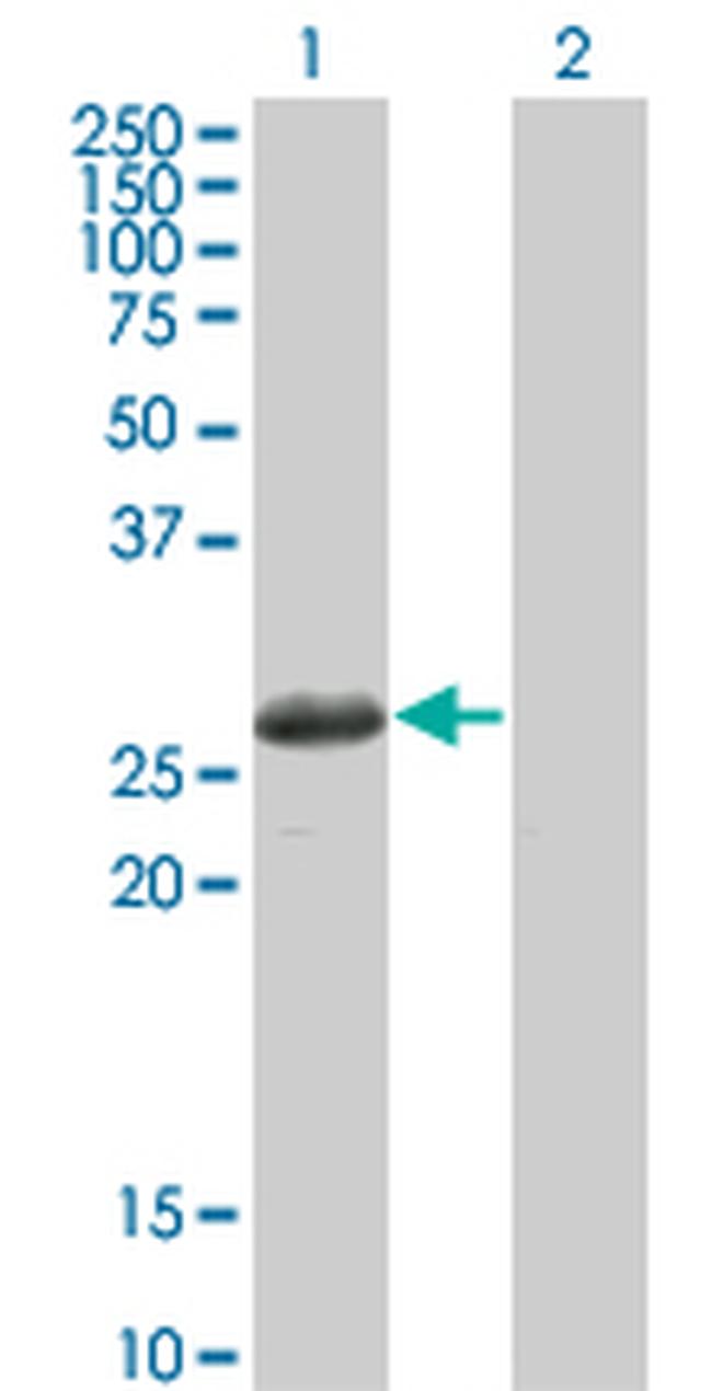 TSSK3 Antibody in Western Blot (WB)