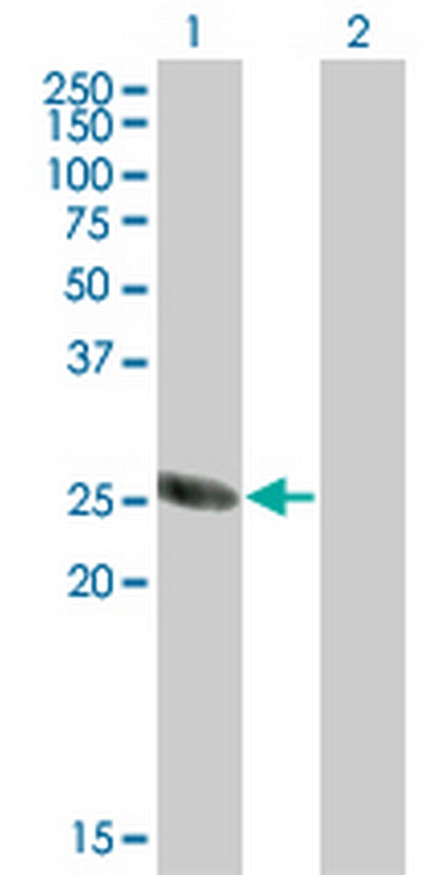 TSSK3 Antibody in Western Blot (WB)