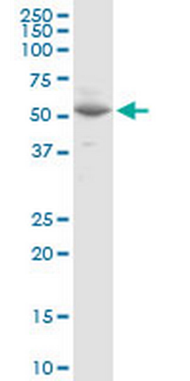 VANGL1 Antibody in Western Blot (WB)