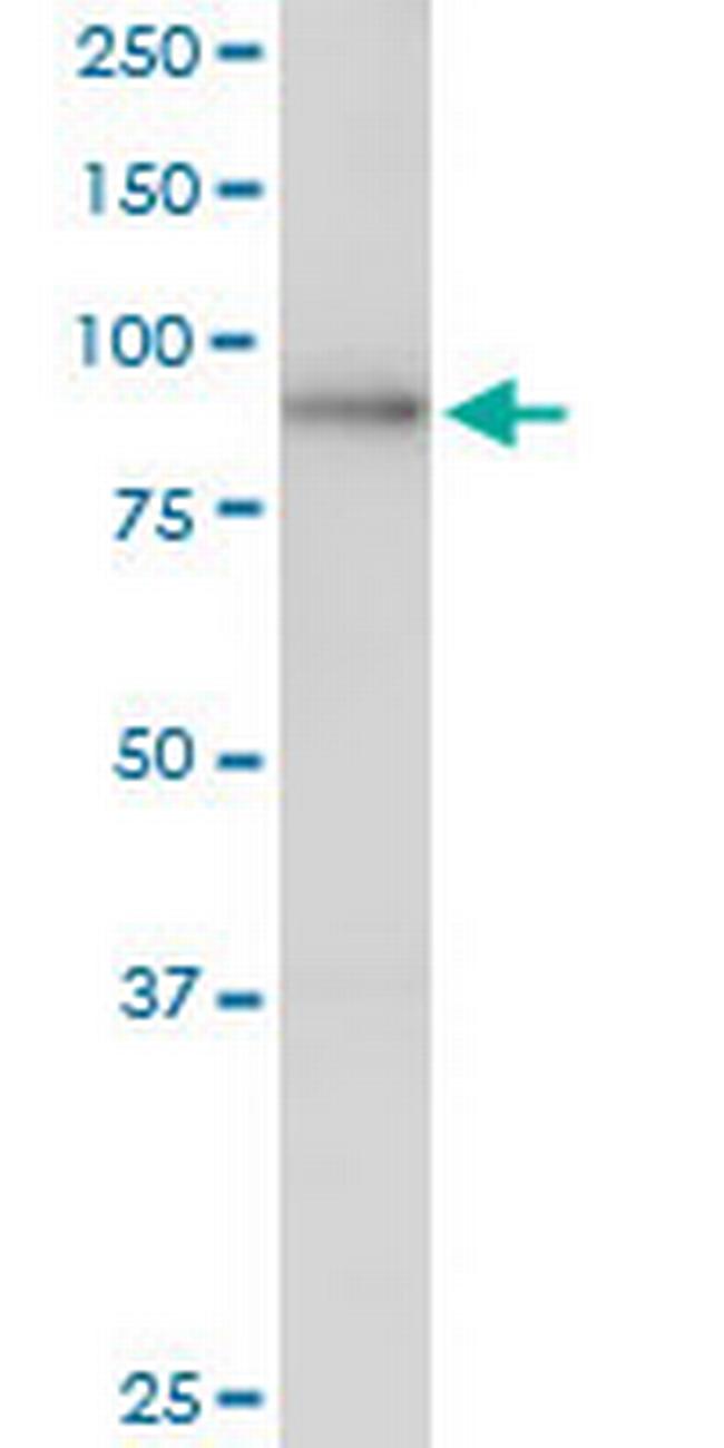 LAS1L Antibody in Western Blot (WB)