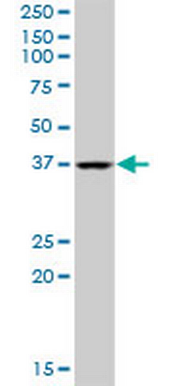 QTRT1 Antibody in Western Blot (WB)