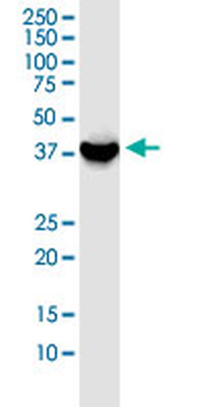 GSG1 Antibody in Western Blot (WB)