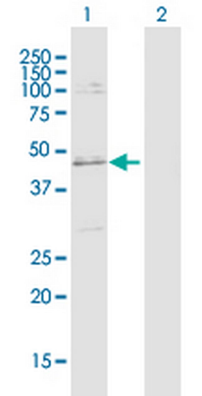 SLC25A31 Antibody in Western Blot (WB)