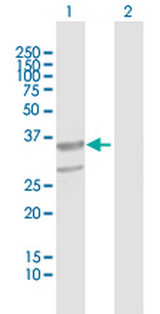 ABHD11 Antibody in Western Blot (WB)