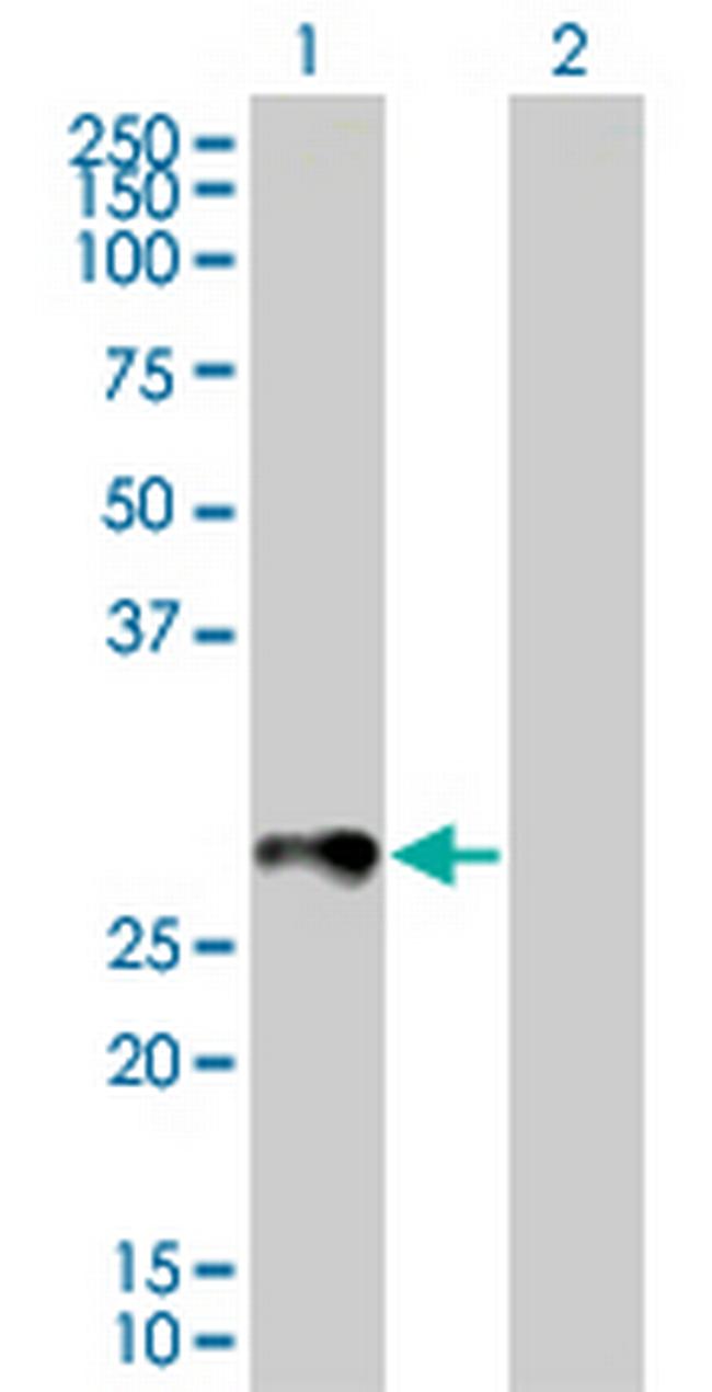 RAB33B Antibody in Western Blot (WB)