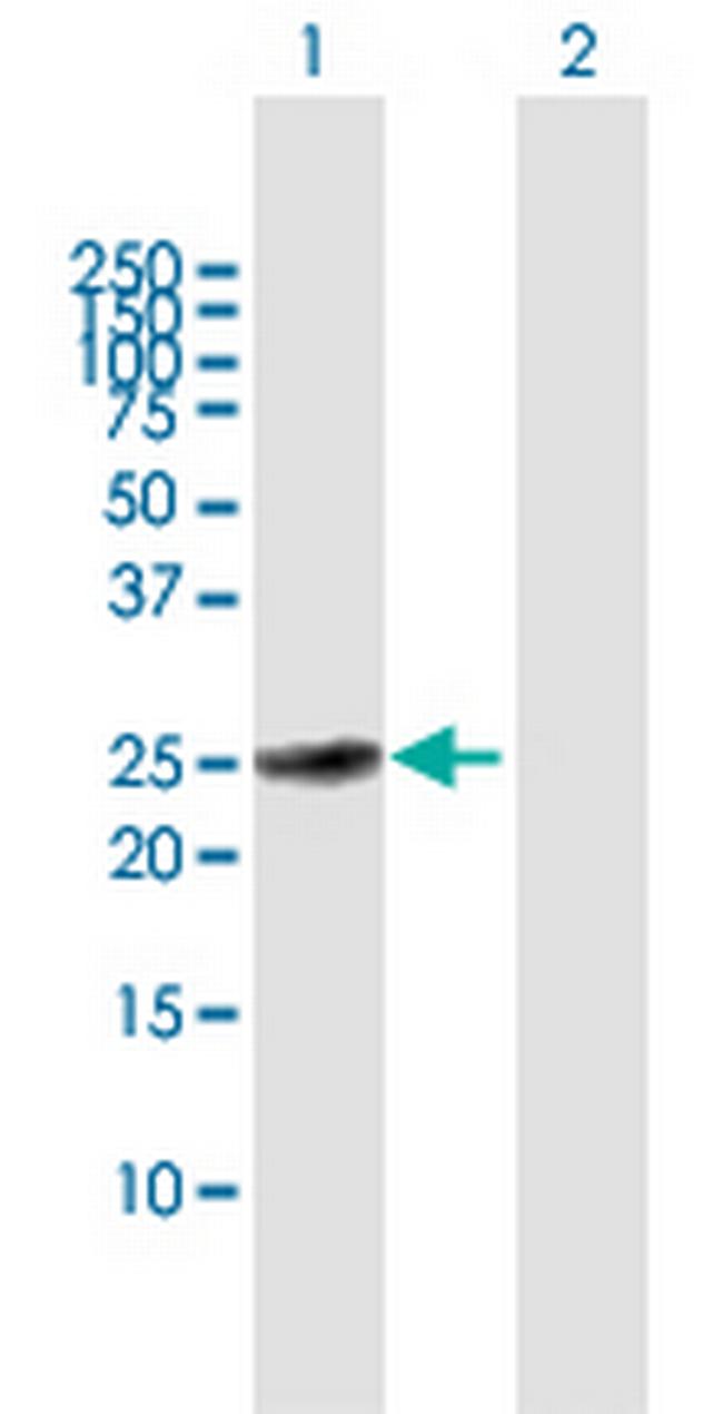 MXD3 Antibody in Western Blot (WB)