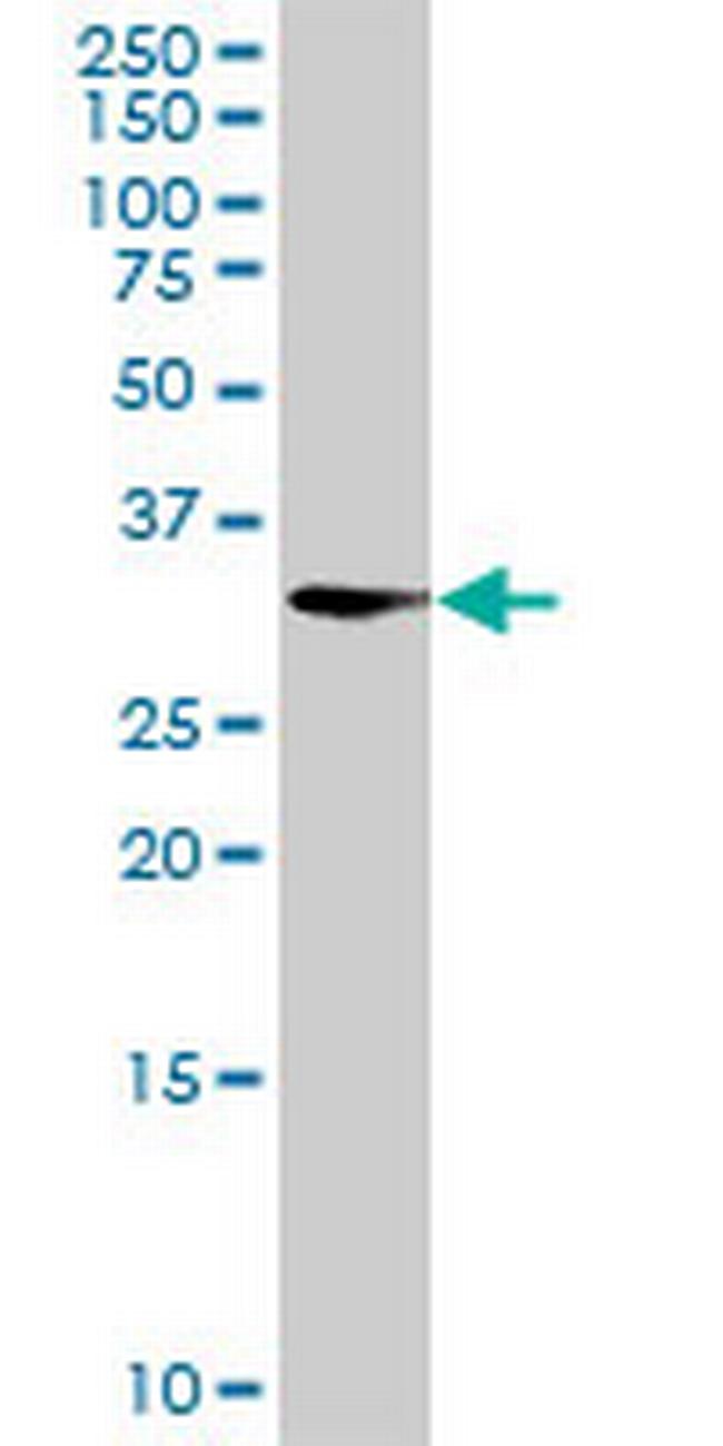 AKR1CL2 Antibody in Western Blot (WB)