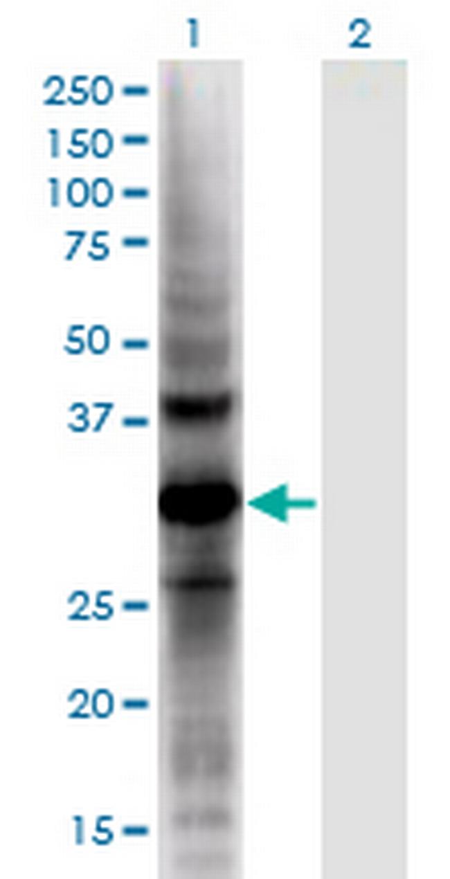 AKR1CL2 Antibody in Western Blot (WB)