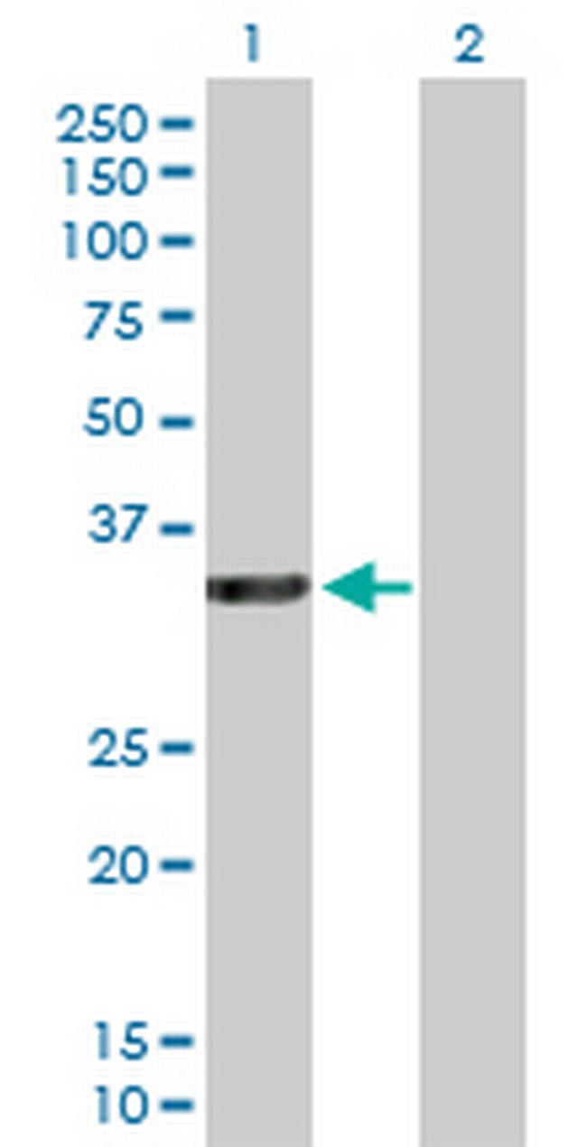 RASSF5 Antibody in Western Blot (WB)