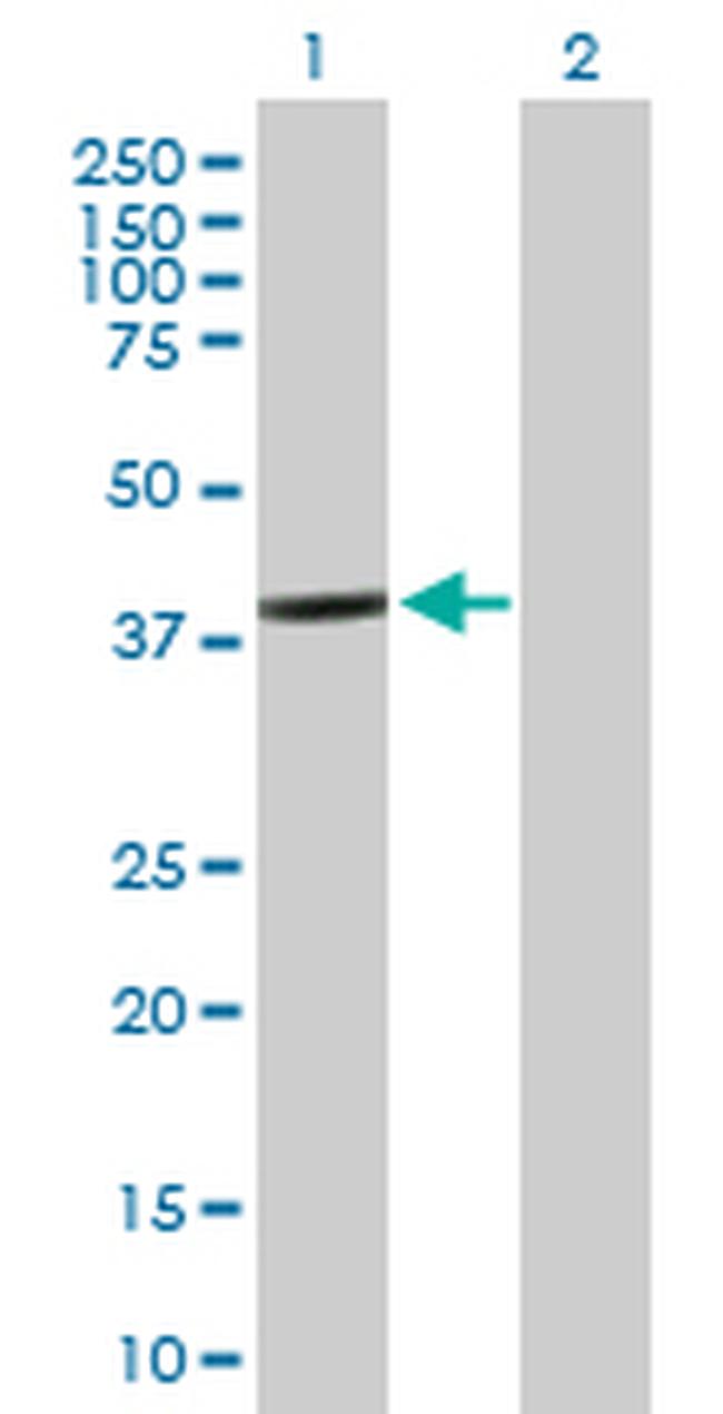 BCL2L12 Antibody in Western Blot (WB)