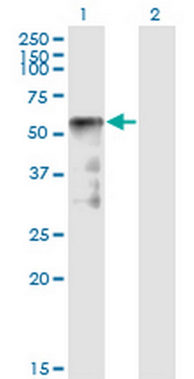 SESN2 Antibody in Western Blot (WB)