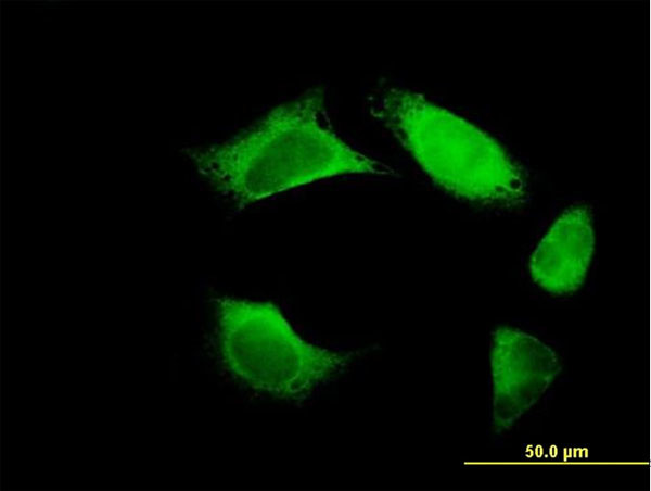 FERMT3 Antibody in Immunocytochemistry (ICC/IF)