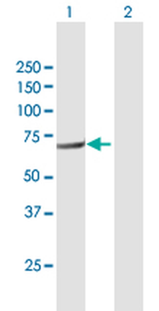 FERMT3 Antibody in Western Blot (WB)