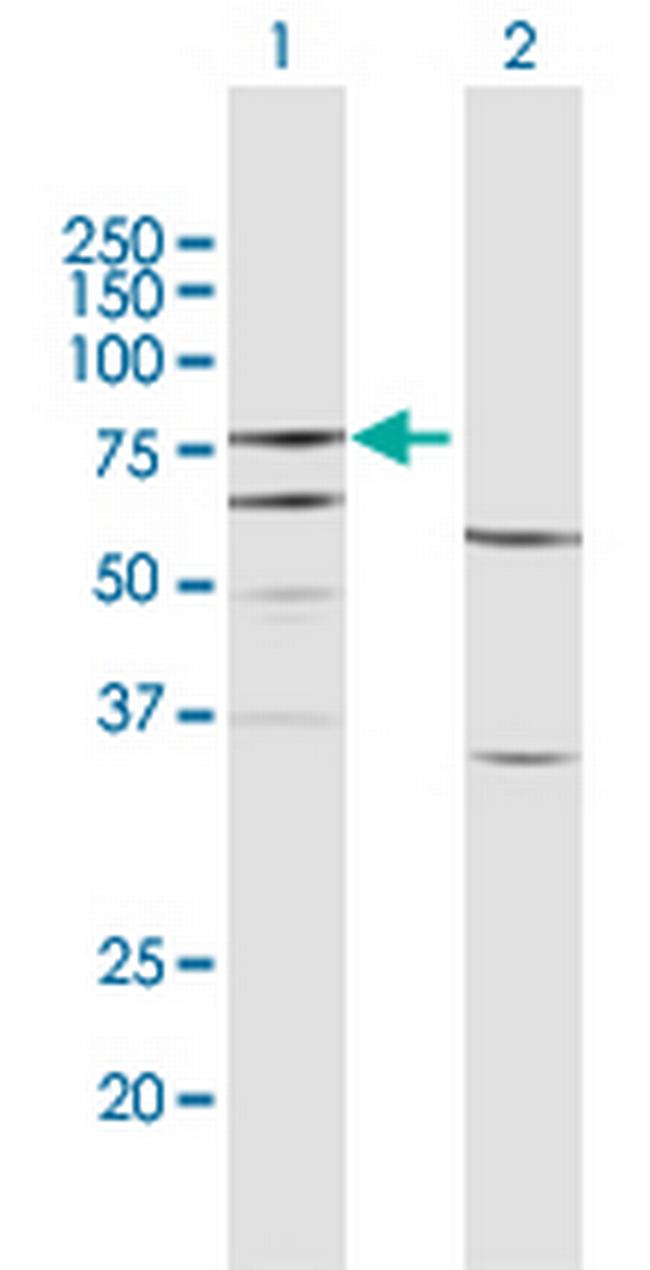 FERMT3 Antibody in Western Blot (WB)