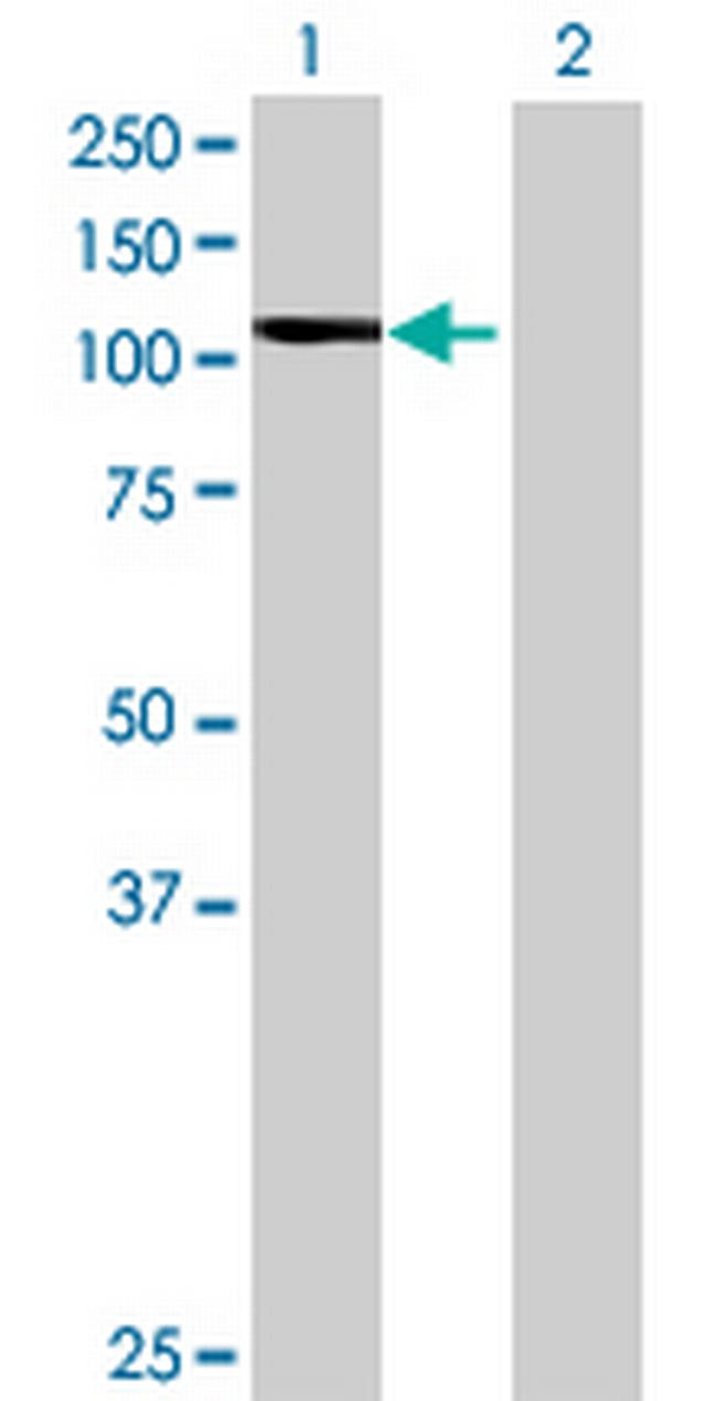 ITCH Antibody in Western Blot (WB)