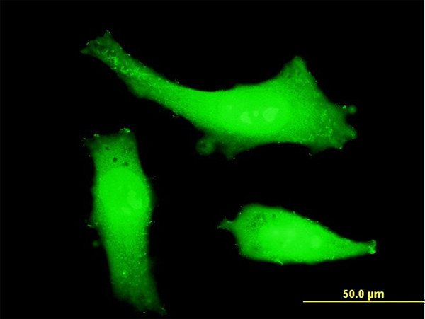 ITCH Antibody in Immunocytochemistry (ICC/IF)