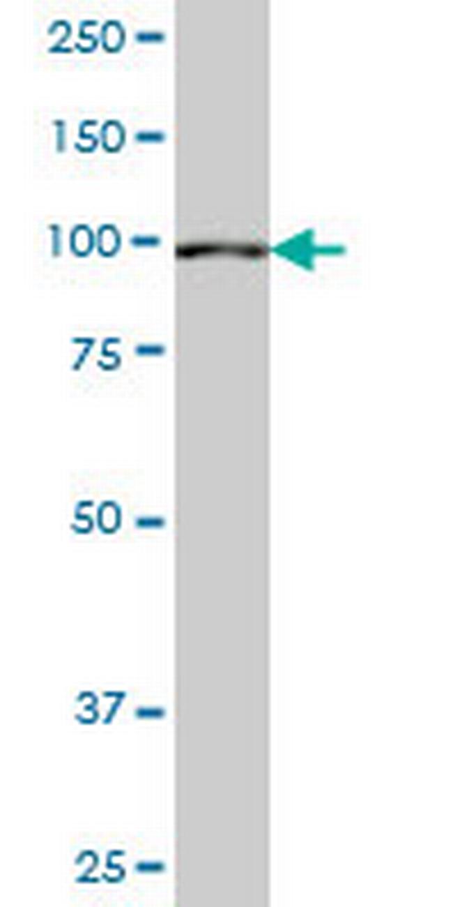 SETDB2 Antibody in Western Blot (WB)