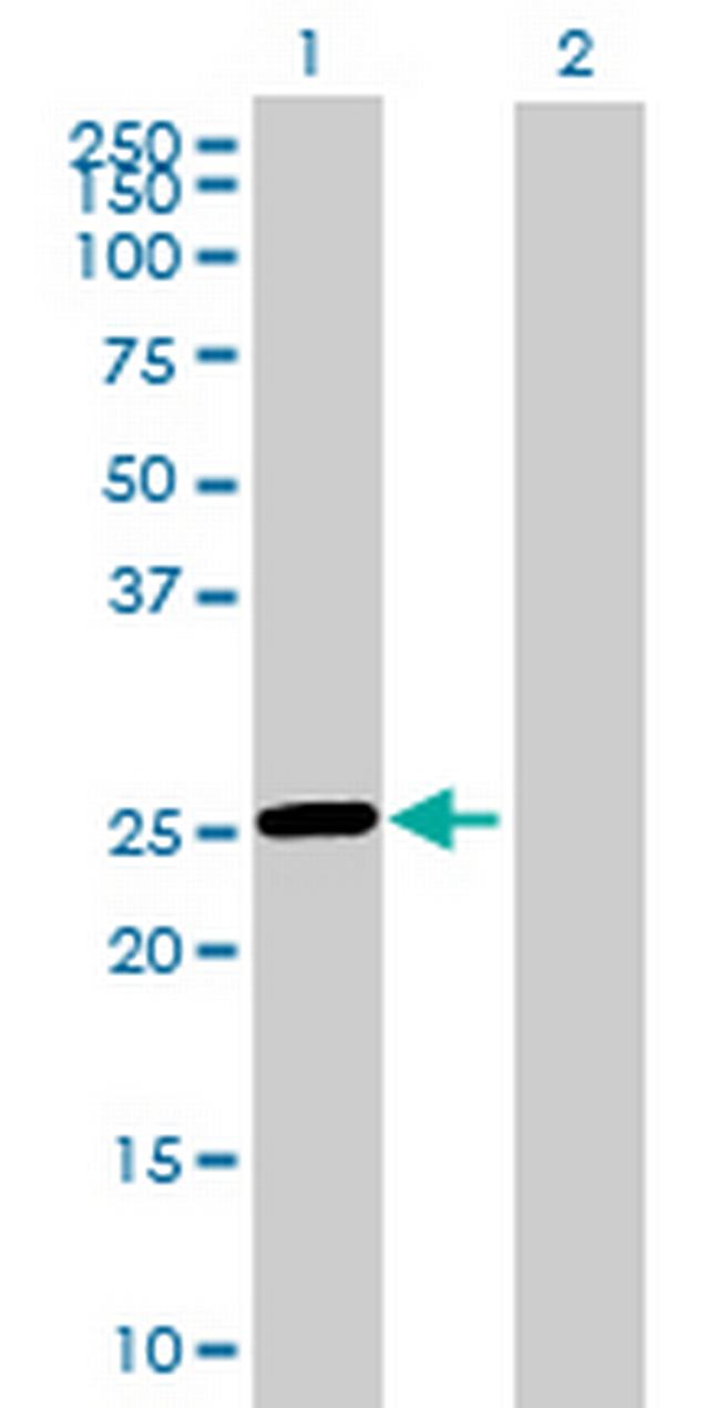 ROPN1L Antibody in Western Blot (WB)