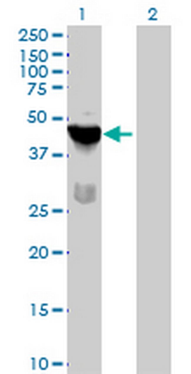 TSSK1B Antibody in Western Blot (WB)