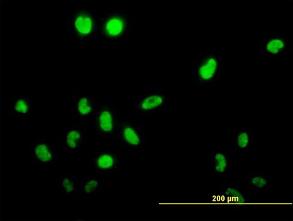 TSSK1B Antibody in Immunocytochemistry (ICC/IF)